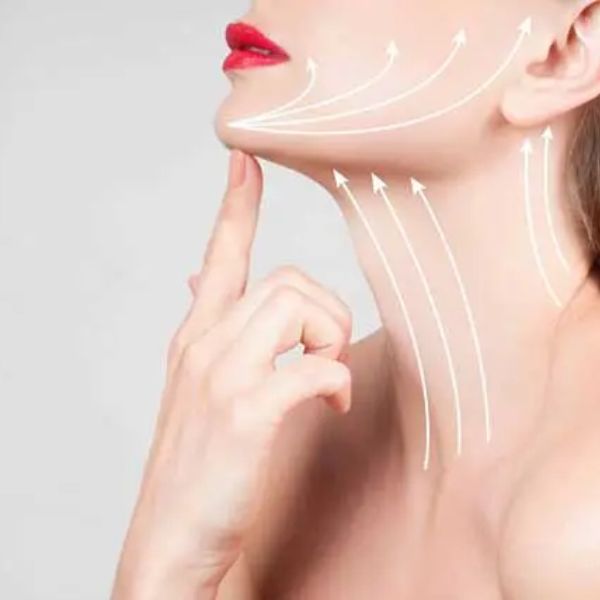 Cheek & Neck Lift