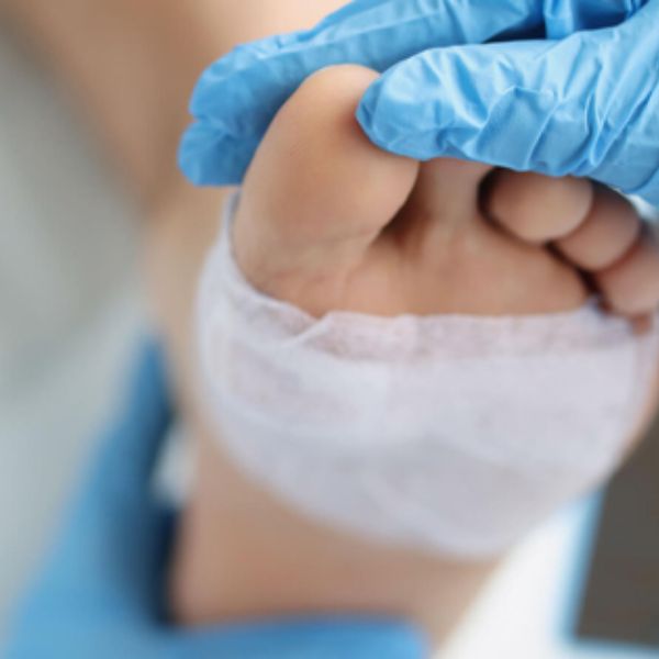 Chronic Wound & Bed Sore Treatment
