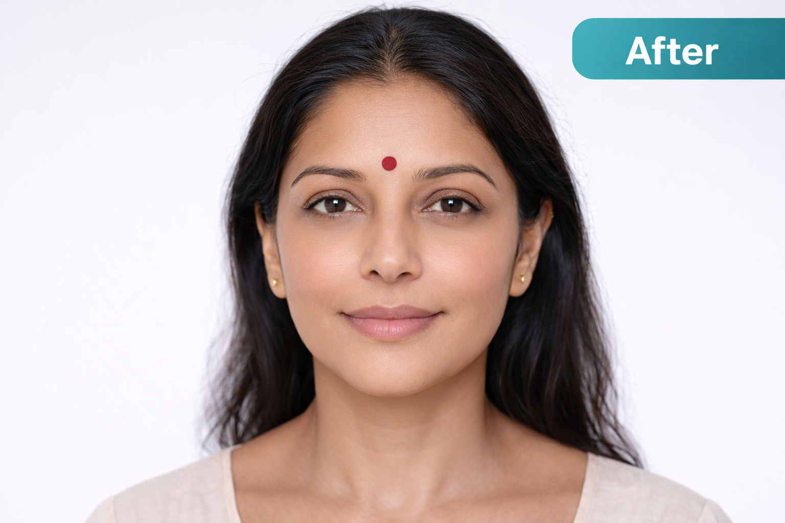 Aesthetic Plastic Surgery Result After