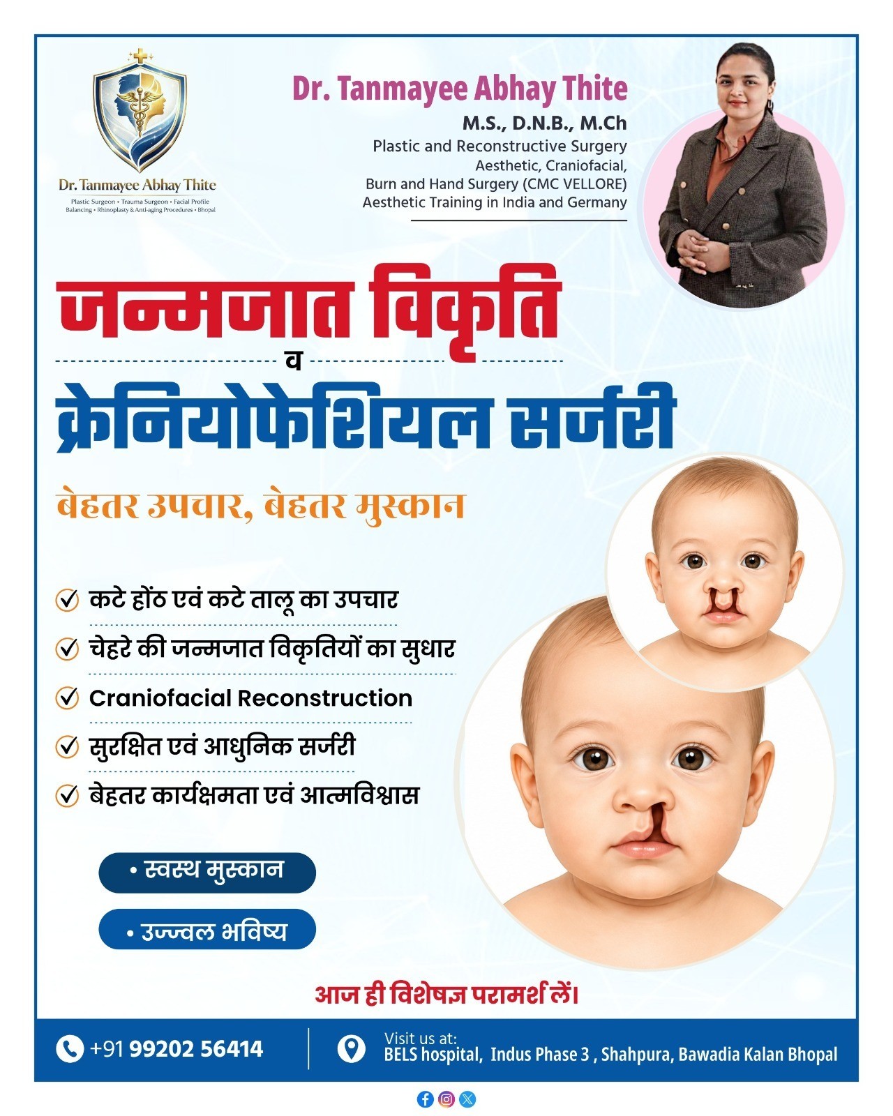 Best Craniofacial Surgery in Bhopal — Expert Treatment by Dr. Tanmayee Abhay Thite